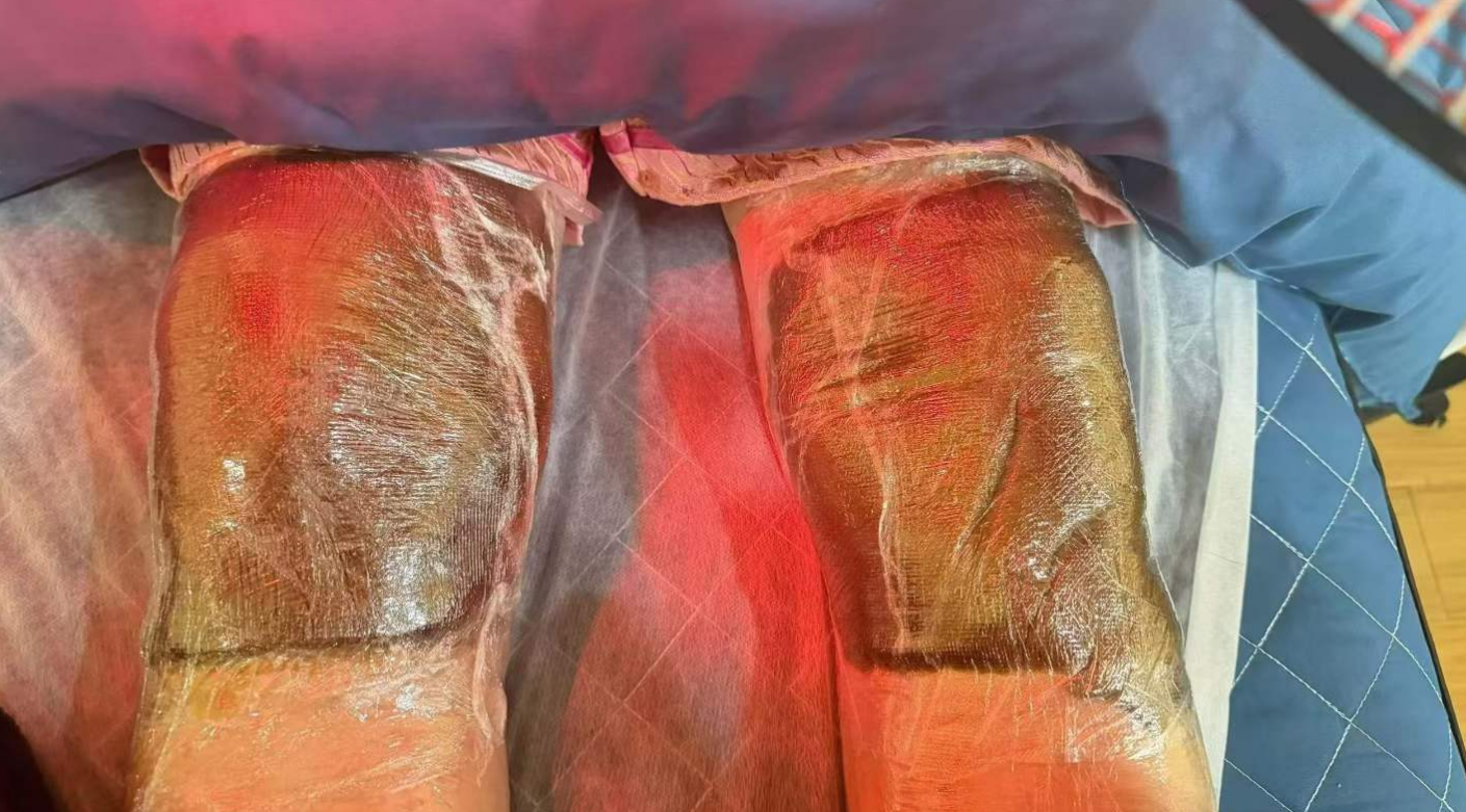 顾客真实见证｜困扰3年的腰腿痛，终于在丛桂草堂疼痛馆这里缓解了