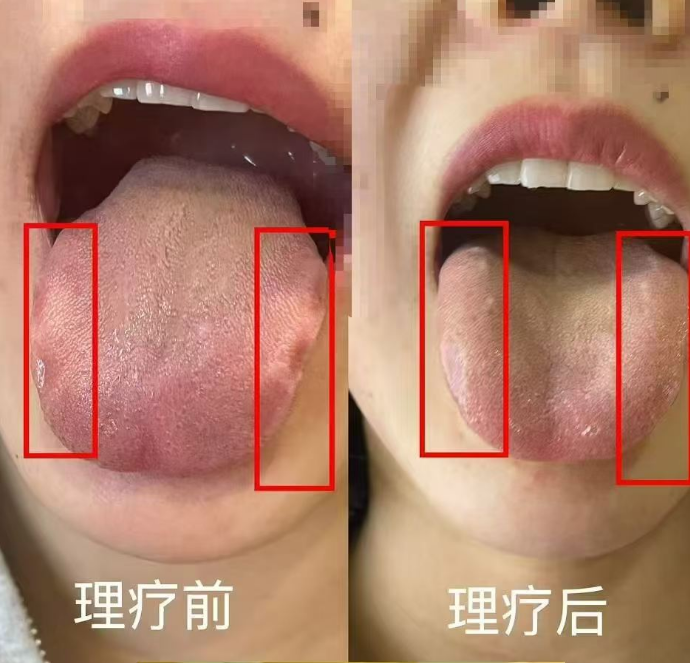 真实顾客见证｜不止筋骨疼痛调理，体态脏腑养护同样效果显著