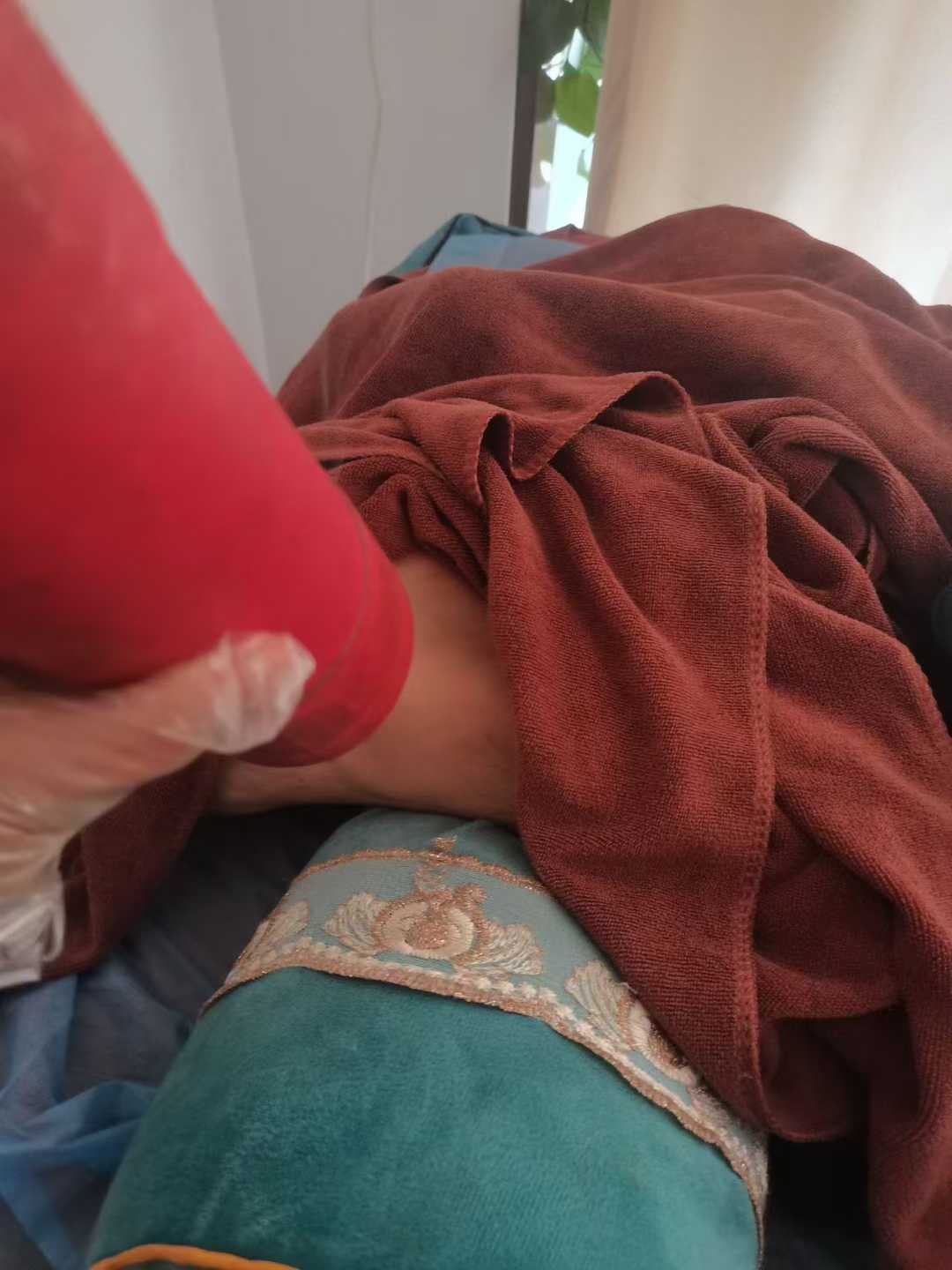 打球崴脚别硬扛！小伙脚踝急性扭伤，经络疏通 + 古法艾灸轻松缓解痛感