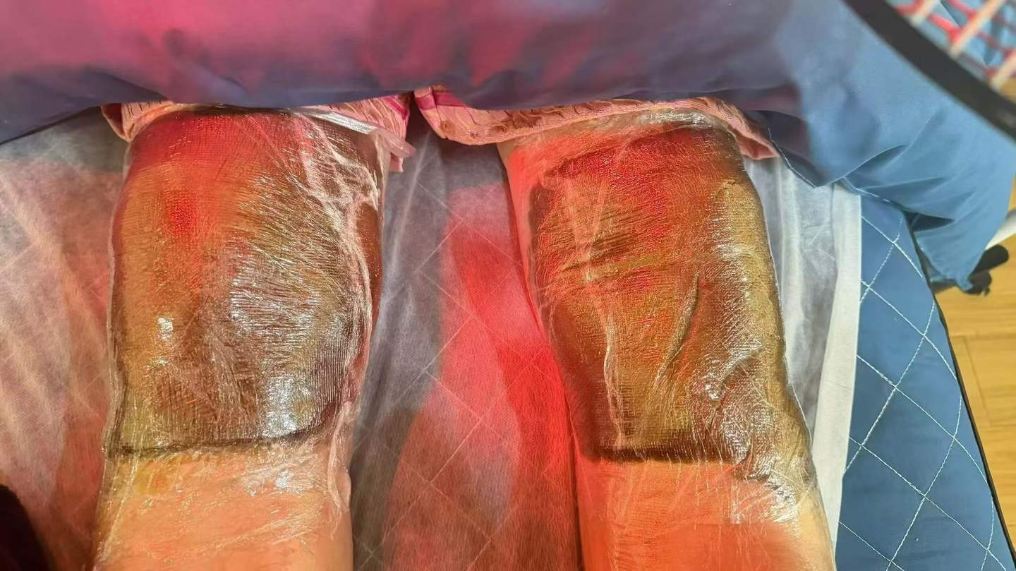 真实顾客见证：多年顽固腰腿痛，在这里得到有效改善